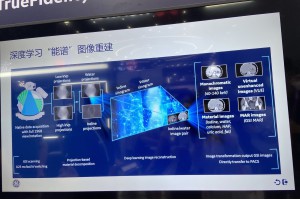 ��AI�������V���g��CTӰ����Ώ�ѩ����׃��4K����